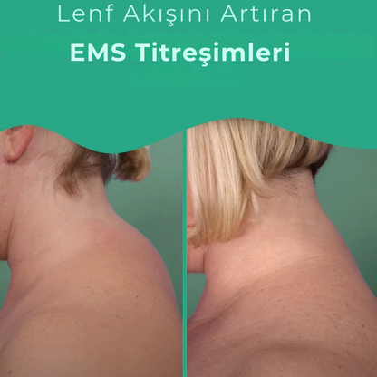 Rezovel Akıllı Boyun Masaj Aleti